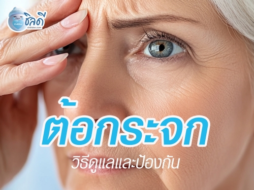 ต้อกระจก คือภาวะที่เลนส์ตาของเราซึ่งปกติจะใส กลับขุ่นมัว ทำให้การมองเห็นไม่ชัดเจน มักเกิดขึ้นช้า ๆ ทีละน้อย จนรู้สึกว่าตามัว เห็นภาพซ้อน หรือมองเห็นสีซีดลง ต้อกระจกสามารถเกิดได้กับคนทุกวัย แต่พบได้บ่อยในผู้สูงอายุ